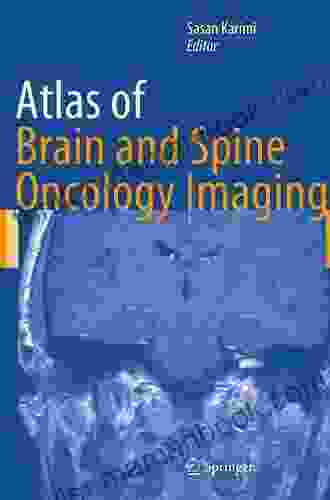 Atlas Of Brain And Spine Oncology Imaging (Atlas Of Oncology Imaging 5)